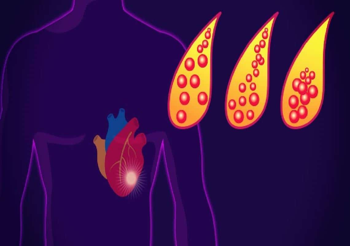 הכירו: חמישה מאכלים שיעזרו לכם לשמור על עורקים נקיים 