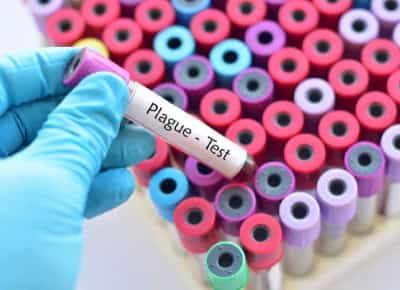 מחלת הדבר שבה לקליפורניה: נופש בקמפינג הפך לסיוט רפואי