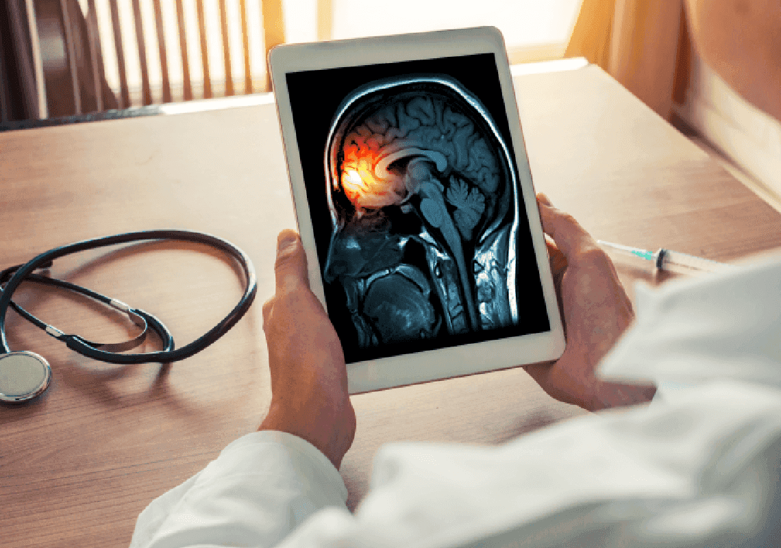 דאגה במקסיקו: 35 בני אדם מתו מהתפרצות מסתורית של דלקת קרום המוח