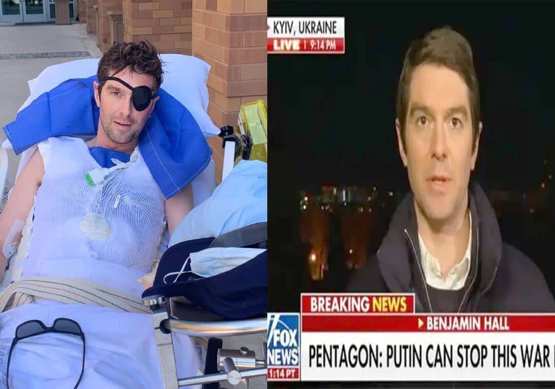 כתב פוקס-ניוז באוקראינה איבד שני רגליים, עין, ויד: "אני בר-מזל להיות בחיים"