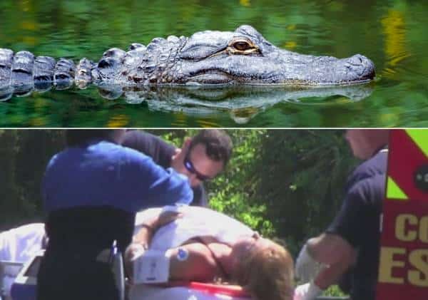 אימה בחופשה באגם: צעירה הותקפה על ידי תנין