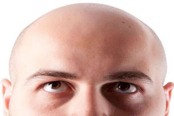 שפשוף נעים או הפתרון להתקרחות: תנו לזקיקי השיער שלכם להריח את זה