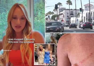 כוכבת הריאליטי קמיל אנדרסון נשדדה באלימות בבוורלי הילס: "הוטחתי בכוח לרצפה"