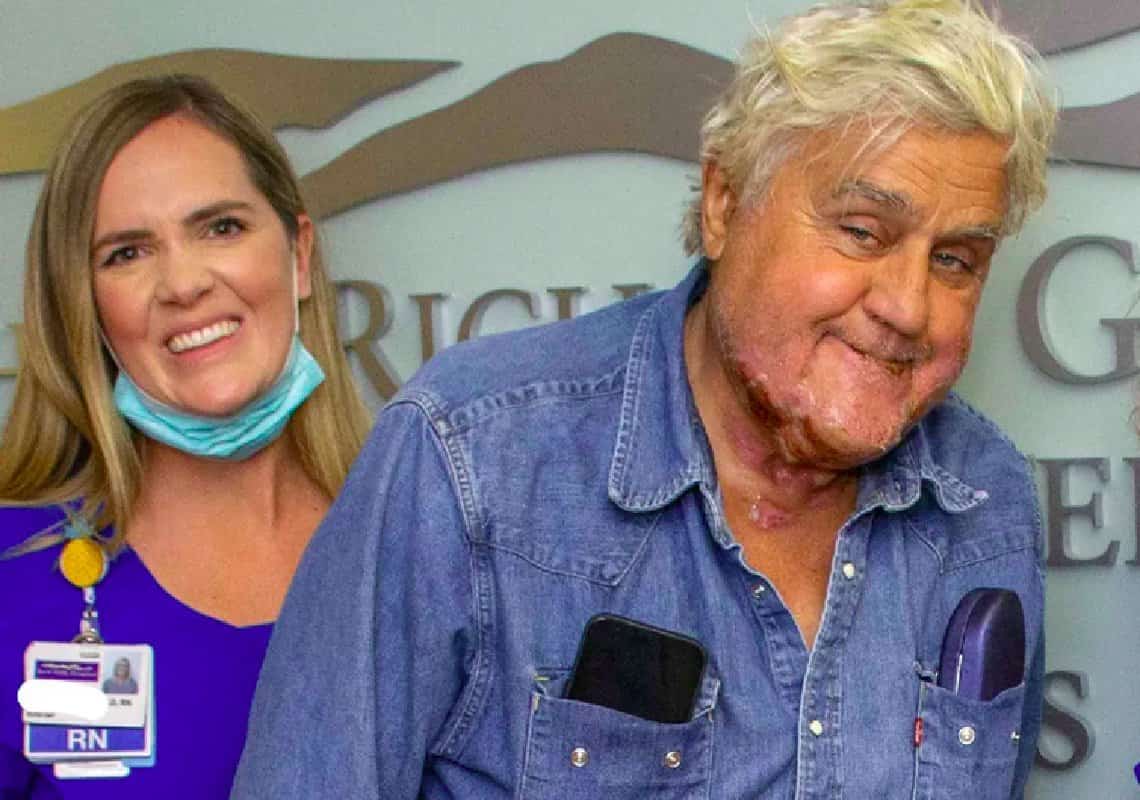 מאז שנכווה בפניו: תמונה ראשונה של ג׳יי לנו