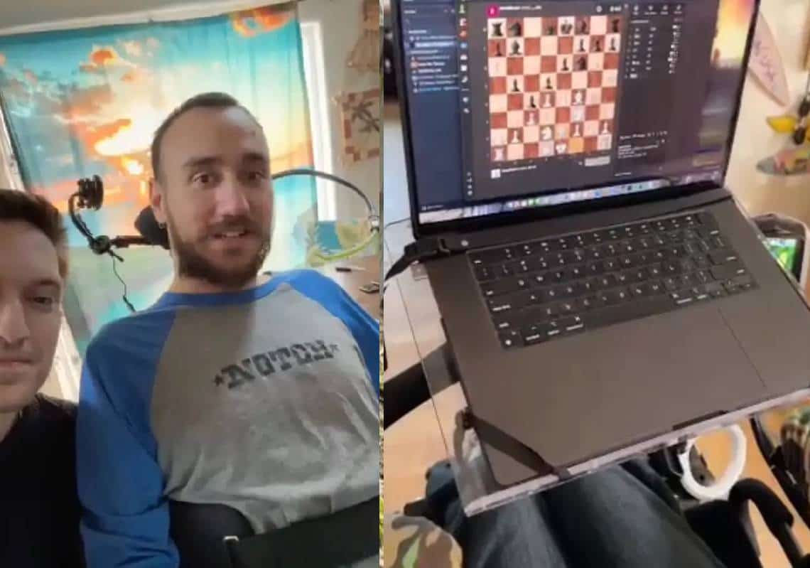 "יכול לשחק משחקי מחשב על ידי 'טלפתיה": שבב המוח של Neuralink הושתל לראשונה בבן אדם