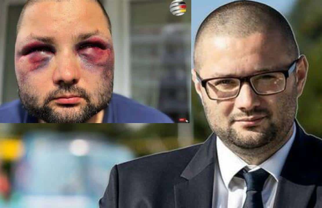 ‏ראש ה-AfD (אלטרנטיבה לגרמניה) הוכה במתקפת מהגרים מאורגנת‏