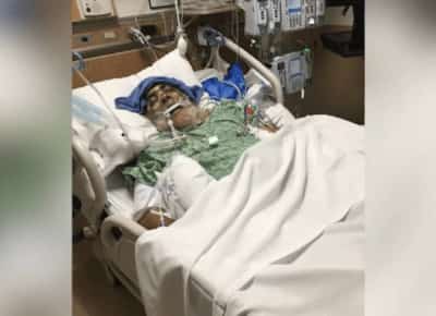 פשע שנאה בלוס אנג'לס: קשיש בן שבעים הותקף באכזריות בוואלי ונמצא בתרדמת