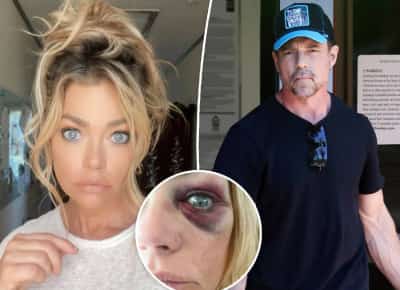 כוכבת "עקרות בית אמיתיות" טוענת לאלימות; בעלה לשעבר מאשים אותה בשתייה