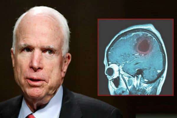 גליובלסטומה או מה גרם למותו של הסנטור, ג'ון מקיין: התחזיות עדיין עגומות  