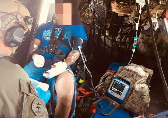 לוס אנג'לס: צעיר נפצע מפיצוץ זיקוק ועשוי לאבד אחת מידיו