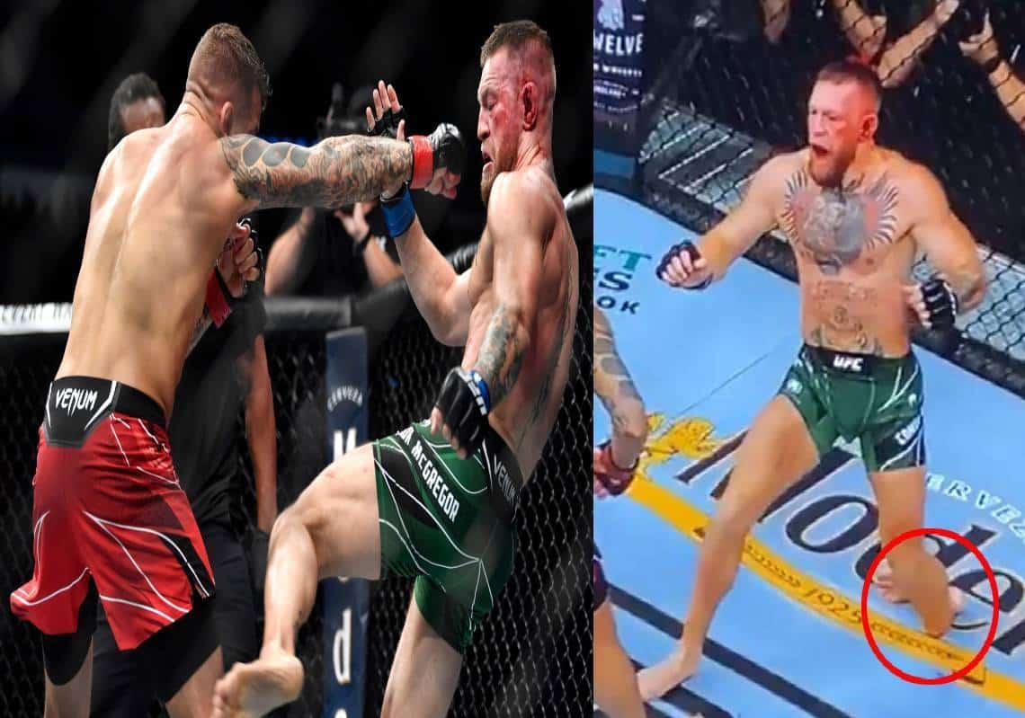 האם היה סימון עם היד? תיאוריה חדשה: "מקרגור בכלל שבר את הרגל בתחילת הקרב"