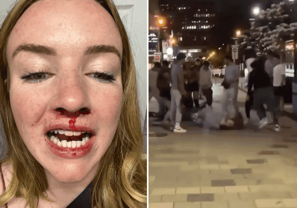 בלב המדינה הפרוגרסיבית: חבורה של מהגרים התנפלה במכות על זוג לסביות 