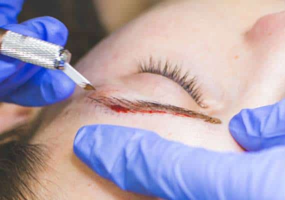 גבות מסוכנות: אישה אושפזה עם דלקת שסיכנה את חייה לאחר שעברה טיפול הזרקת פיגמנט לעיצוב גבות 