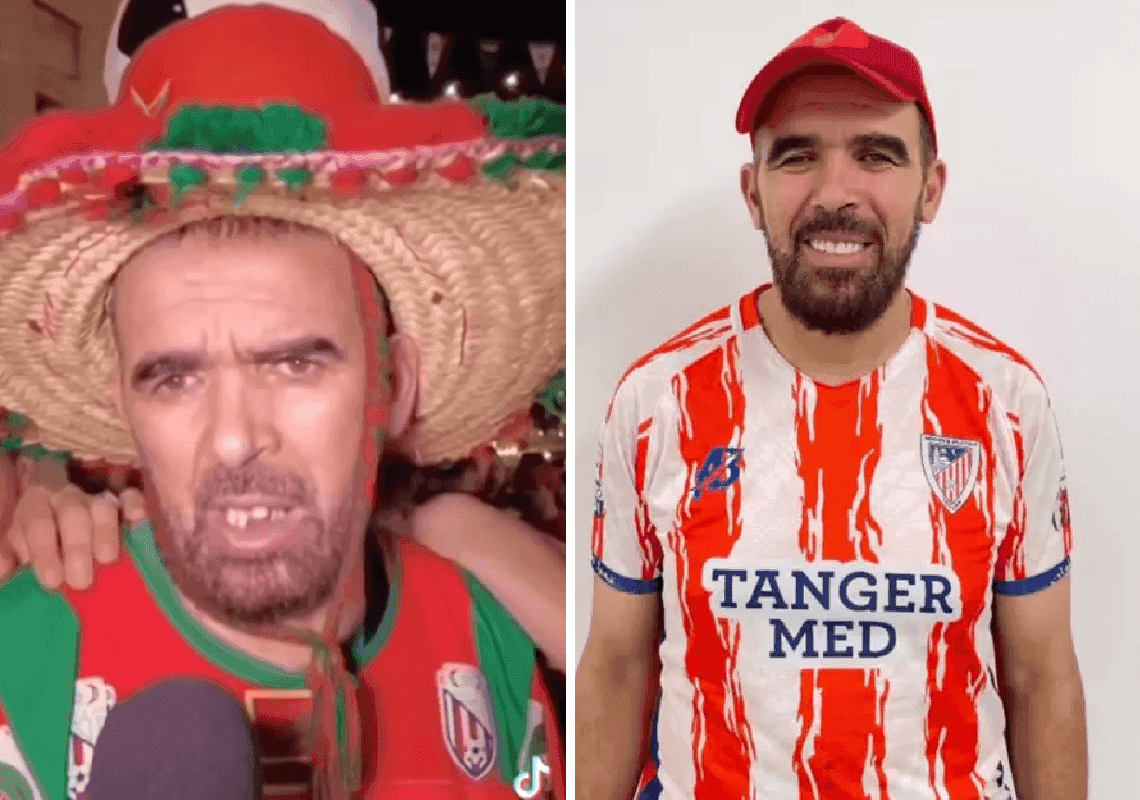 מרגש: אוהד מהמונדיאל שהוטרד בגלל החיוך שלו - קיבל שיניים חדשות בחינם 