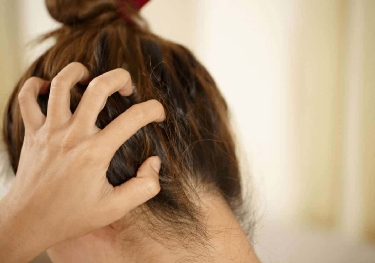 הקרקפת לא מפסיקה לגרד? אלה הסיבות הנפוצות שכדאי להכיר