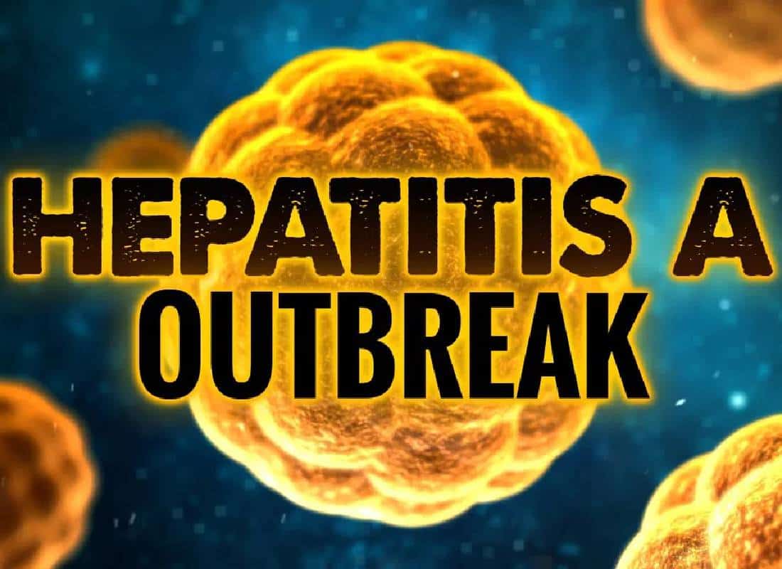 התפרצות הפטיטיס איי במחוז לוס אנג'לס: "חייבים להקדים את המחלה"