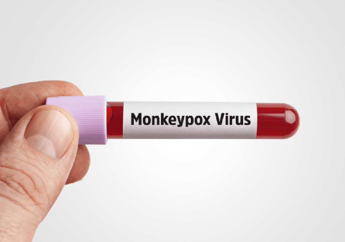 מומחים מזהירים: הממשל איטי - ארה"ב בדרך לאבד שליטה על אבעבועות הקופים