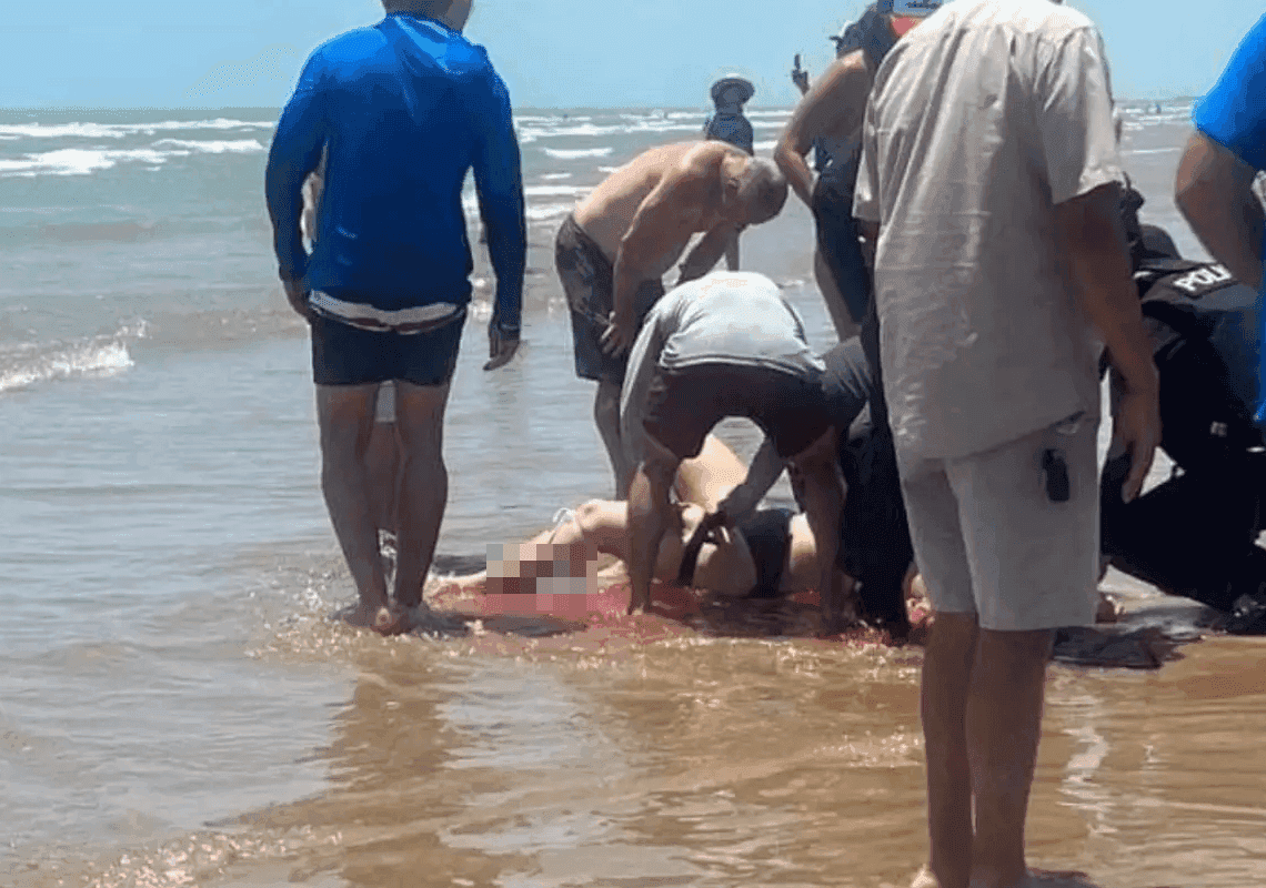 תמונות קשות לצפייה מטקסס: חמישה בני אדם הותקפו על ידי כריש