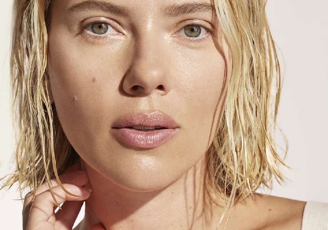 סקרלט ג'והנסון נזכרת בימי האקנה בצעירותה: ״זה היה נורא״