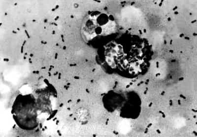 שובו של החיידק מ'המגפה השחורה'? תושב קליפורניה במהלך קמפינג בטבע