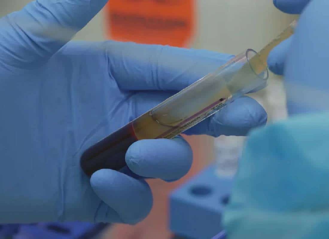 "מדאיג יותר מכל מגפה": קיצוצים דרסטיים ב-NIH מאיימים על עתיד המחקר הרפואי בארה"ב