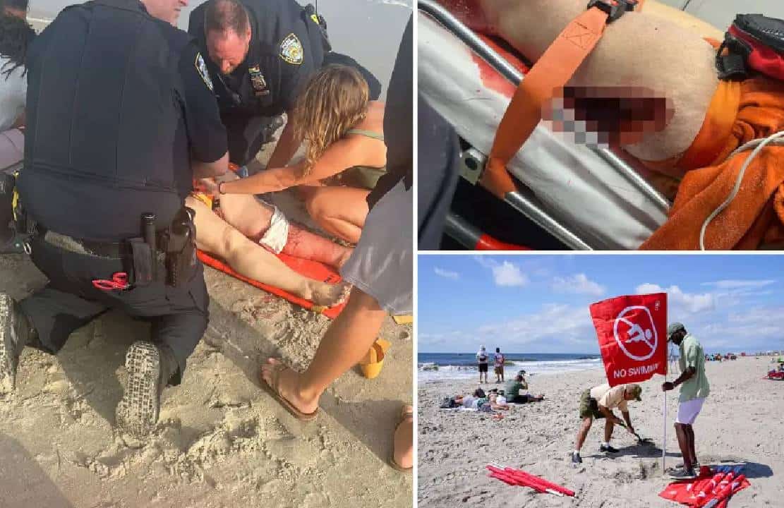 קורבן מתקפת הכריש הראשונה בניו יורק מאז 1953: איבדה 8 קילוגרמים של בשר בתקיפה הנדירה