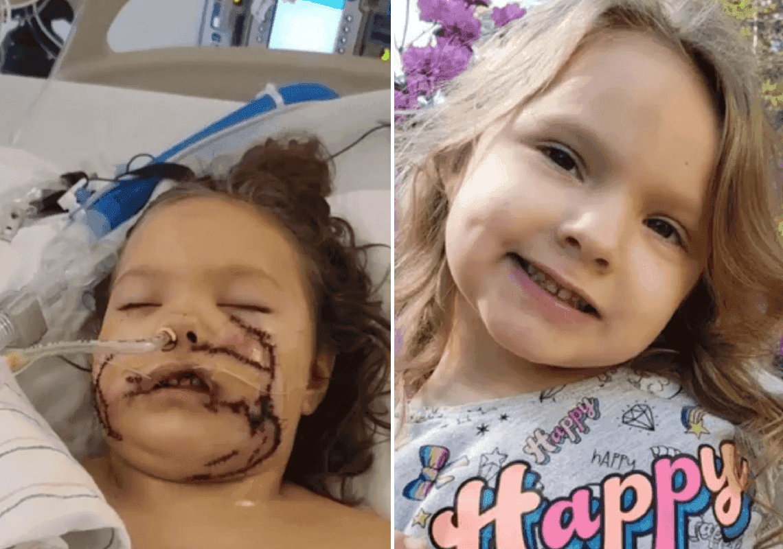 "לעולם לא תחזור לחייך": בת 6 הותקפה קשות על ידי פיטבול  