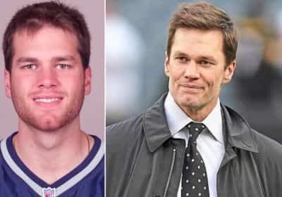 מנתחת פלסטית חושפת: אלו ההליכים שעשויים להסביר את המראה הצעיר של טום בריידי