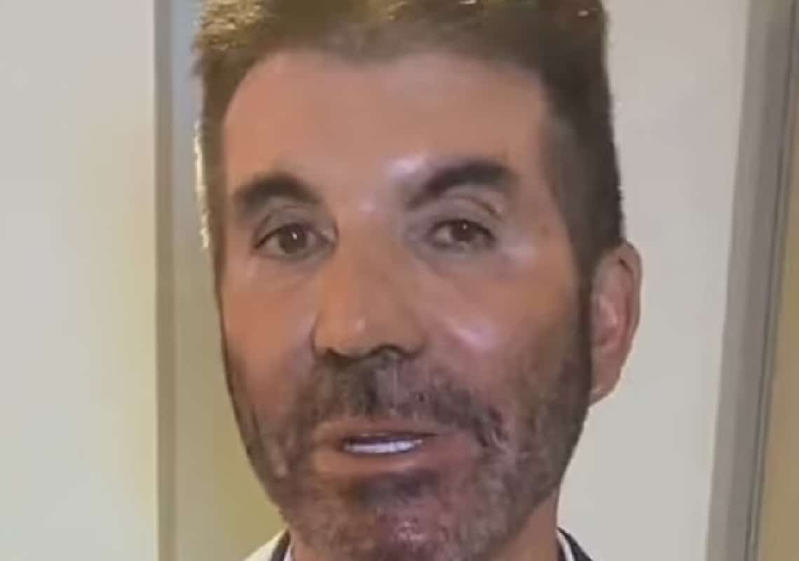 הגזים עם הבוטוקס: הלוק החדש של סיימון קאוול מעורר דאגה בקרב המעריצים