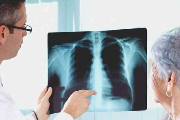 אתם לא רוצים להגיע למקום הראשון בעולם בדירוג הזה: ליגת הסרטן