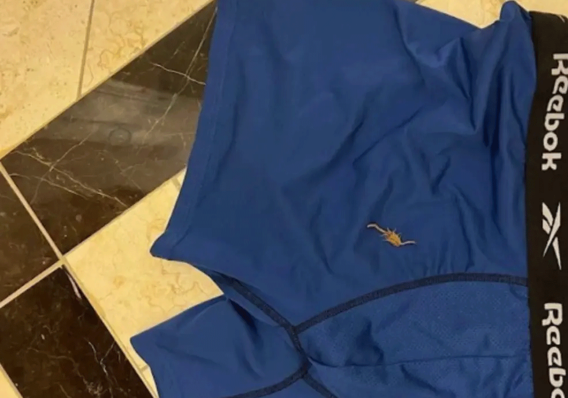 ישראלי תושב לוס אנג'לס בילה במלון הוונישן בלאס וגאס ולפתע התעורר עם כאבים חדים: כשבדק גילה עקרב בתוך התחתונים 