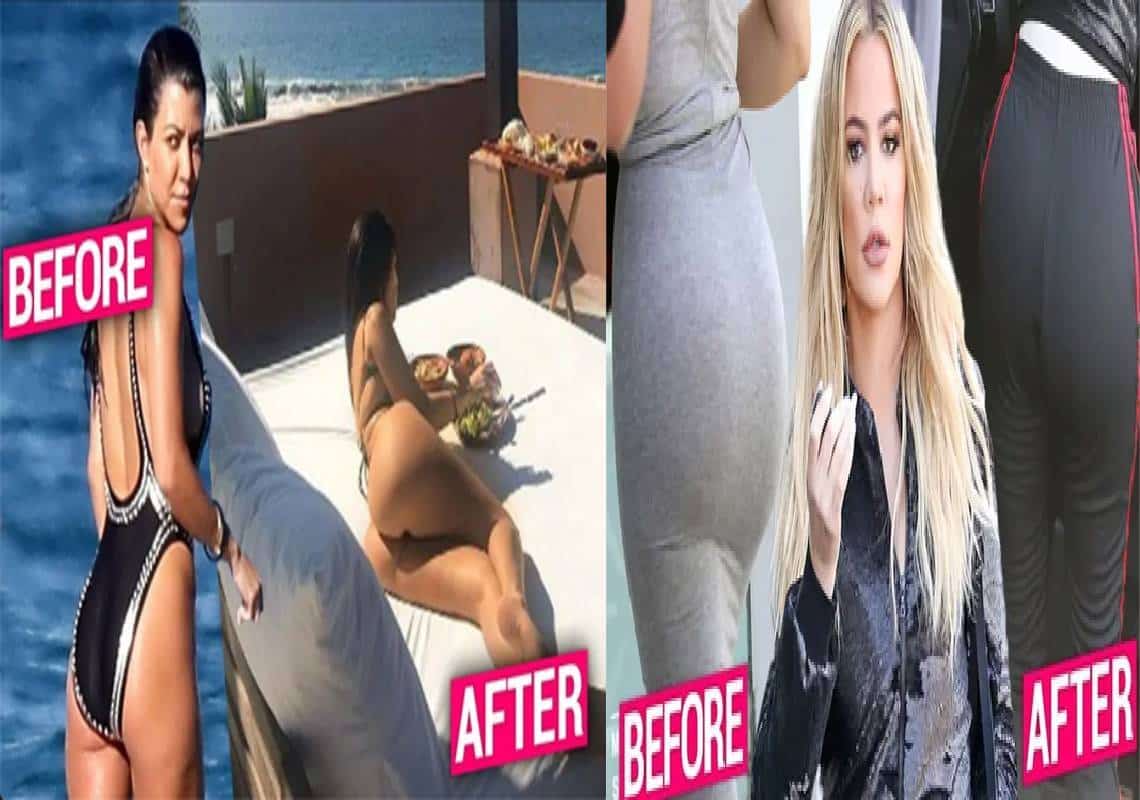 "היו משועממות על הספה וצפו בדוגמניות אינסטגרם": הביקוש להשתלות ישבן שבר שיאים במהלך מגיפת הקורונה