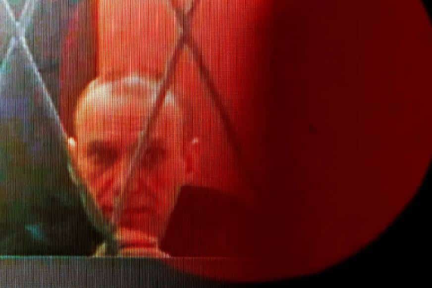 מוות אלים: "נבלני פרכס ללא שליטה ונמצא עם חבלות על גופו"