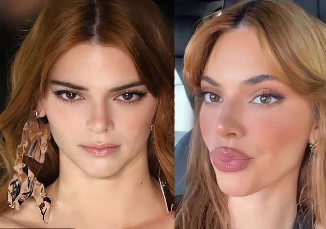 ״הגזימה לגמרי״: המעריצים קוטלים את קנדל ג׳נר