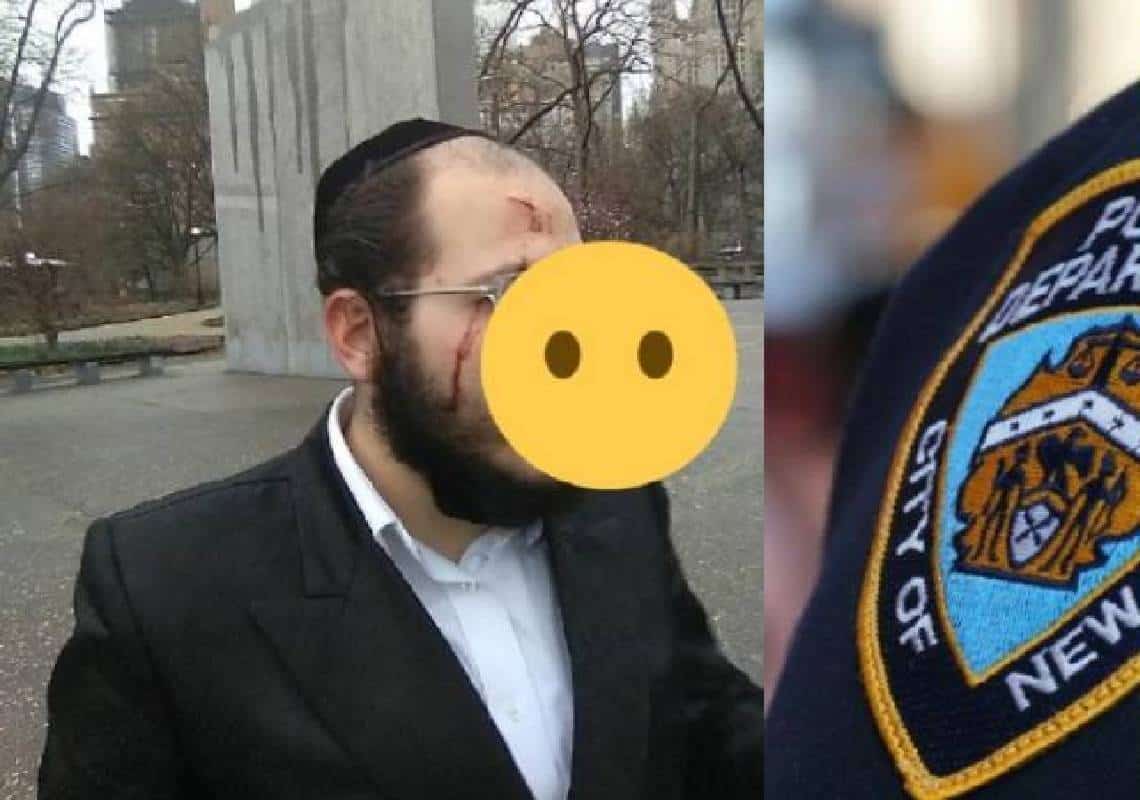 פשע שנאה בחול המועד: משוחרר בערבות על ניסיון-רצח חתך בסכין את פרצופה של משפחה יהודית בלב מנהטן