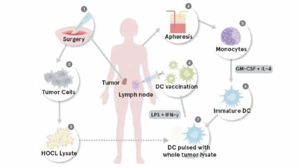 מחקר: חיסון מותאם אישית מסייע לחולות בסרטן הרחם להתמודד עם המחלה ומעלה את סיכויי ההישרדות 