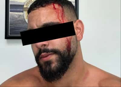 עשו עליי לינץ': ישראלי הותקף באכזריות בלוס אנג'לס על ידי 20 פרו־פלסטינים