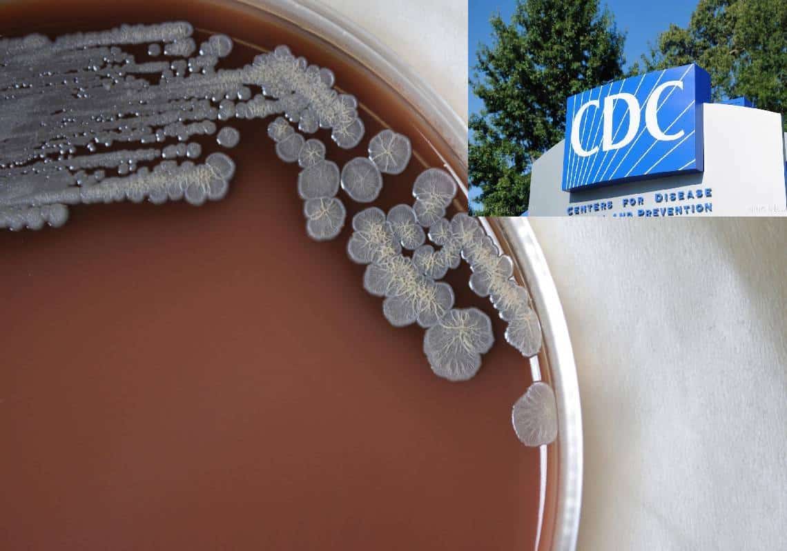 ה-CDC באזהרה נדירה: "נגיף חדש הגורם למחלת מוח והזיות התגלה באמריקה"