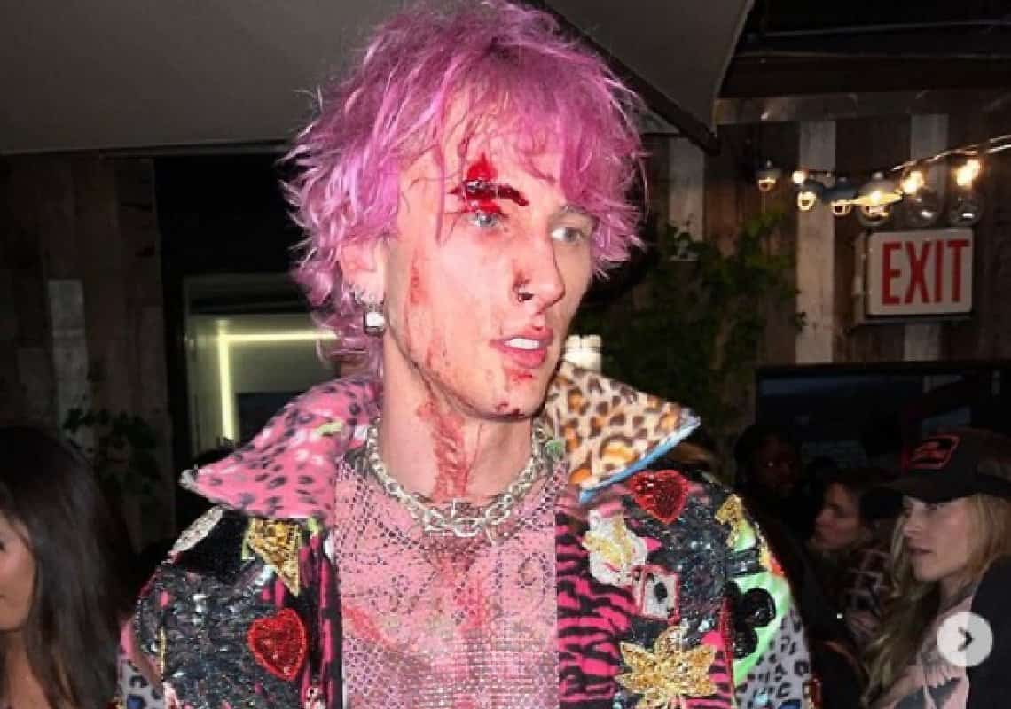 בזמן הופעה: בן זוגה של מייגן פוקס שבר כוס על פניו ודימם 