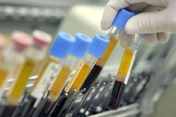  כמה זמן נשאר לכם לחיות? בדיקות דם חדשות יכולות לגלות את התשובה