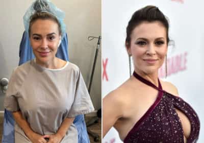 אליסה מילאנו מסירה את השתלים בחזה: "הגוף שלי נוצל והוגזם מינית"