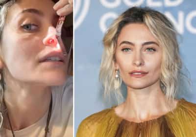 בתו של מייקל ג'קסון חושפת חור בתוך האף: "אל תעשו סמים, ילדים"