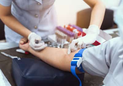 בדיקת דם חדשה יכולה לזהות סרטן עד עשר שנים לפני הופעת הסימפטומים