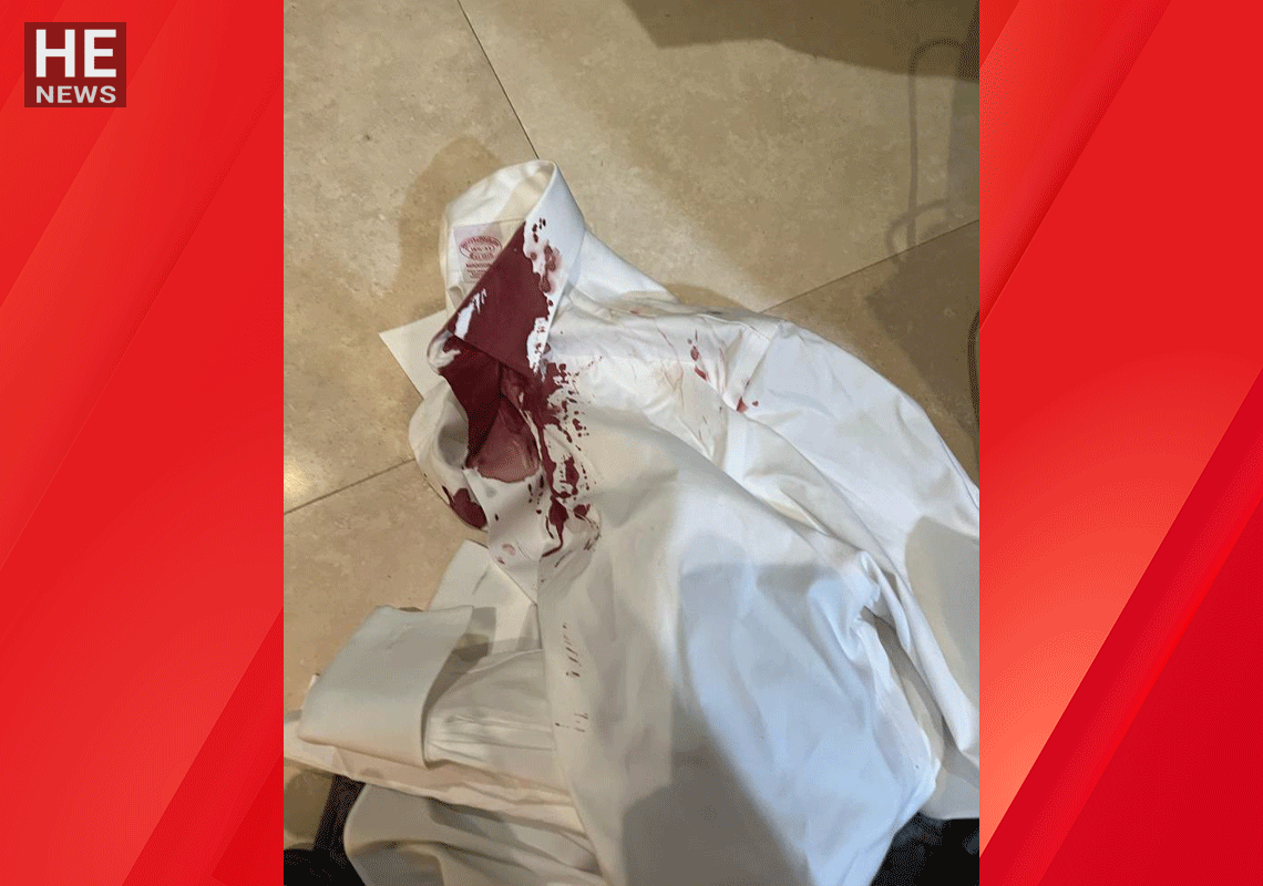 "יהודים, תביאו לי את התכשיטים": תקיפה אנטישמית אלימה בבוורלי הילס בדרך לבית הכנסת 