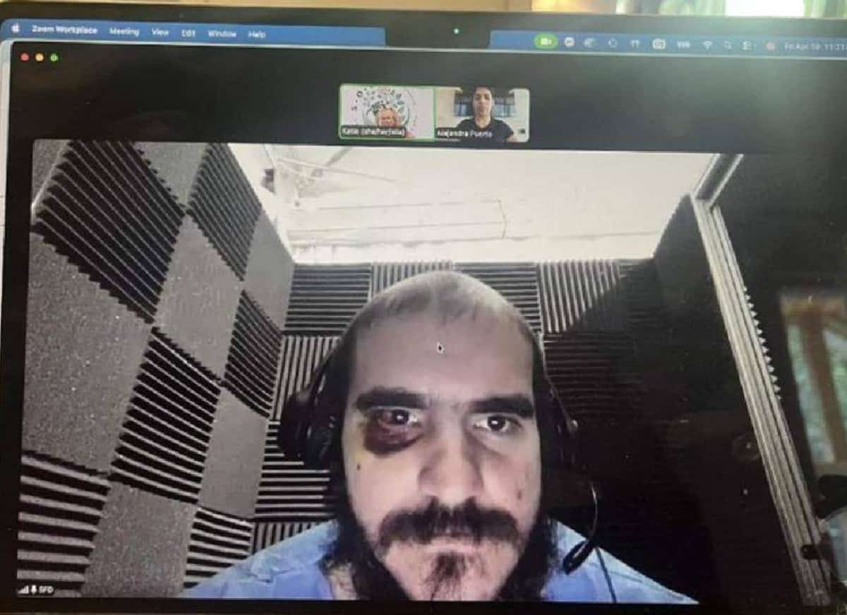 מאחורי הגדרות של "אליגייטור אלקטרז": בית משפט פדרלי שומע על עינויים, התעללות וחוסר רחמים