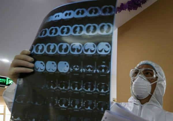 למרות הכרזת החירום: מחסור עצום בערכות לזיהוי נגיף הקורונה בקליפורניה