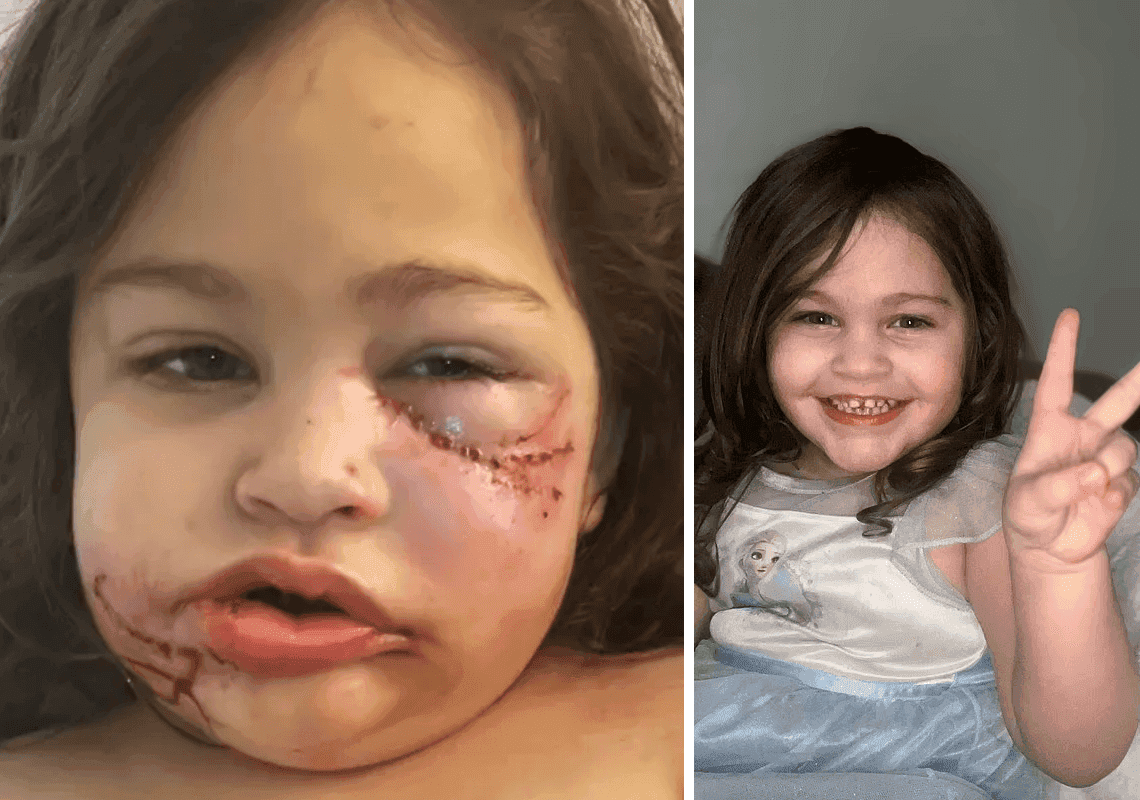 בגלל כלב אומנה: רק בת 3 - ולא תוכל לחייך יותר