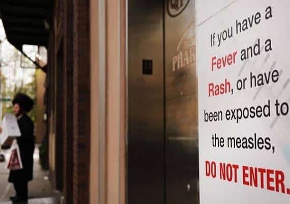 הולך ומחמיר: מגפת החצבת מגיעה למספרים שלא נראו 25 שנה