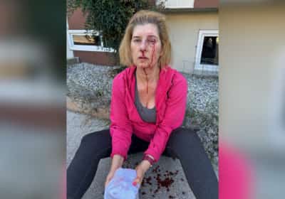 תושבת לוס אנג'לס הותקפה באכזריות בידי חסר בית מחוץ לביתה