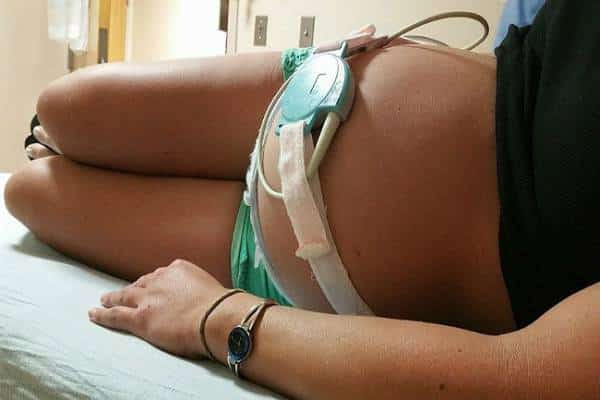 יש יתרונות לצו פינוי: או למתן טיפול המעודד לידה בשבוע ה-39 